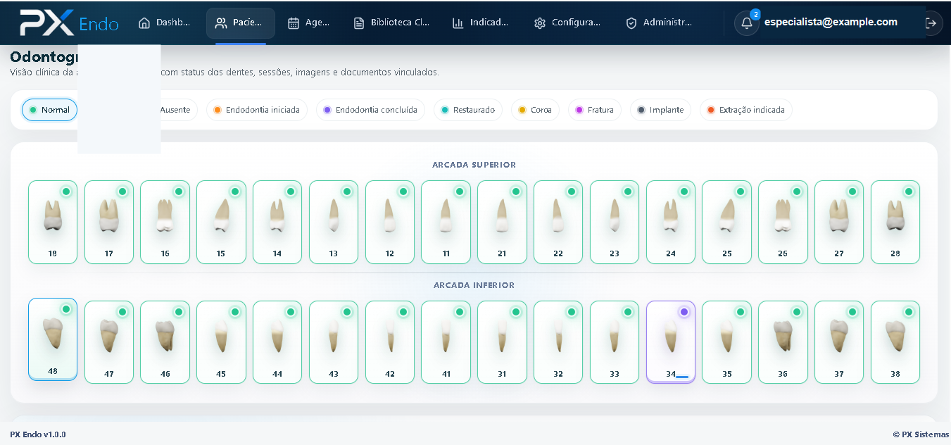 Odontograma anonimizado do PX Endo com visão visual da evolução clínica